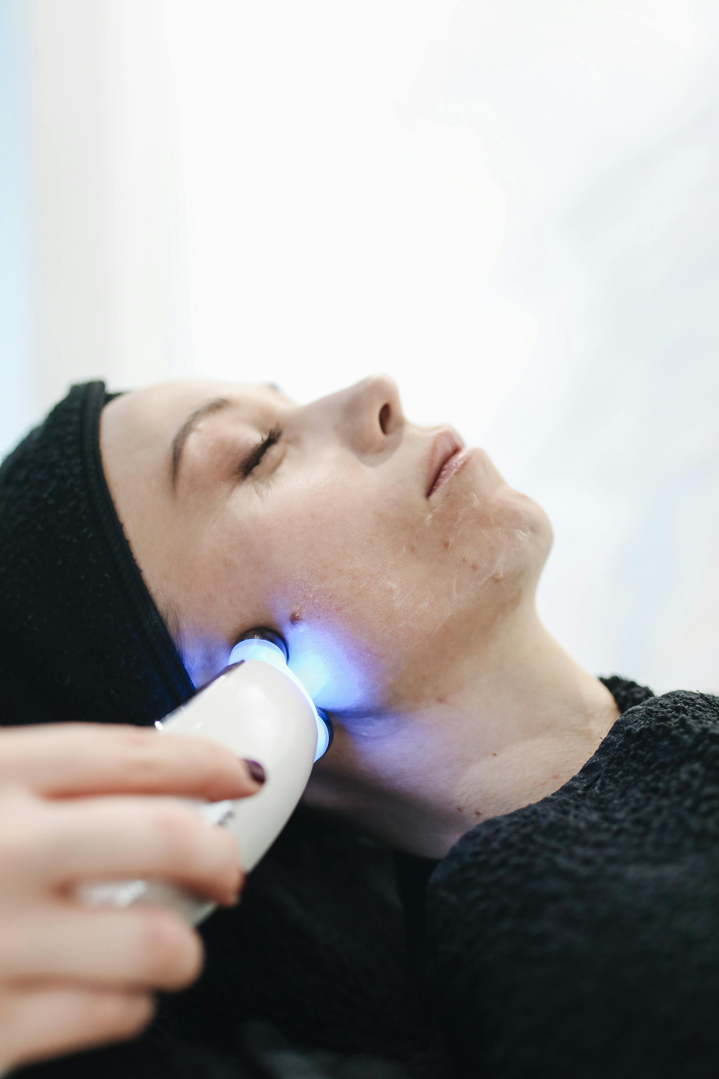 kryo facial