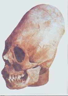 Estas deformaciones en las cabezas egipcias son casi id�nticas a las de algunos cr�neos incas del museo de Lima.