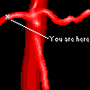 Hepatic Artery