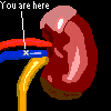 Left Kidney