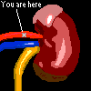Left Kidney