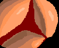 Tricuspid