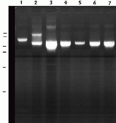 Gel de PCR