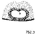 {short description of image}