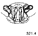 {short description of image}