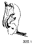 {short description of image}