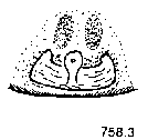 {short description of image}
