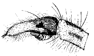 {short description of image}