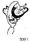 {short description of image}