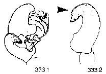 {short description of image}