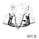 {short description of image}