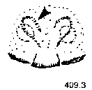 {short description of image}