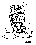 {short description of image}
