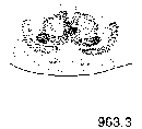 {short description of image}