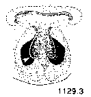 {short description of image}
