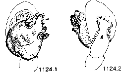 {short description of image}