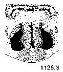 {short description of image}