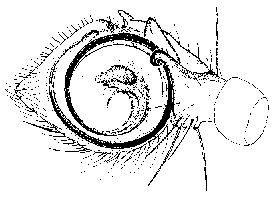 {short description of image}