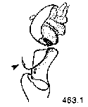 {short description of image}