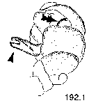 {short description of image}