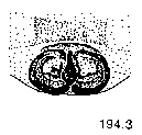 {short description of image}