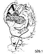 {short description of image}