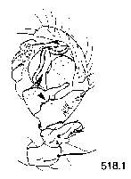 {short description of image}