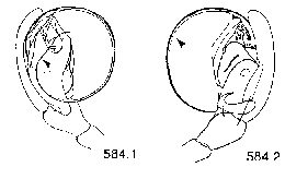 {short description of image}