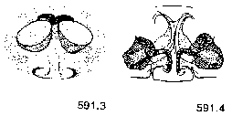 {short description of image}