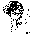 {short description of image}