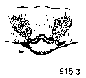 {short description of image}