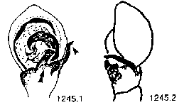 {short description of image}