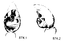 {short description of image}