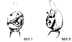 {short description of image}