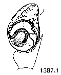{short description of image}