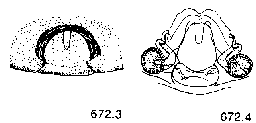 {short description of image}