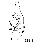 {short description of image}