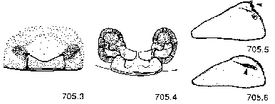 {short description of image}