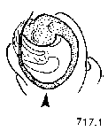{short description of image}
