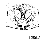 {short description of image}