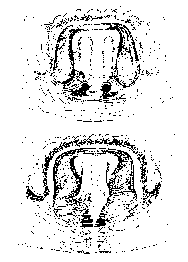 {short description of image}