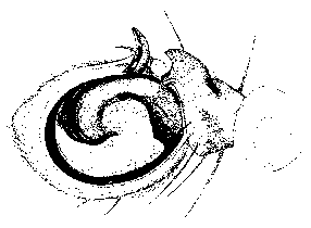 {short description of image}