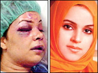 Rania al-Baz before and after her beating (Arab News)