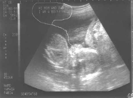 Daniel Sonogram