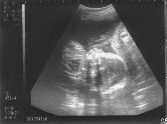 Daniel Sonogram - 18Kb