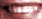 mymouth.jpg - 1038 Bytes