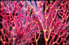 coral05