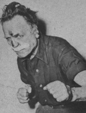 In his later years, Bat was still fighting - even if on the streets. This is how he looked after being attacked by thugs.