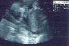 sonogram1 - 43k