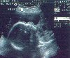 sonogram2 - 52k